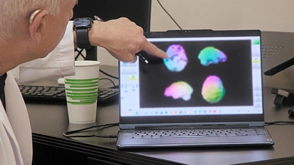 Kim Kardashian’s Brain Scan Reveals Alarming News: “Low Activity” Sparks Concerns!