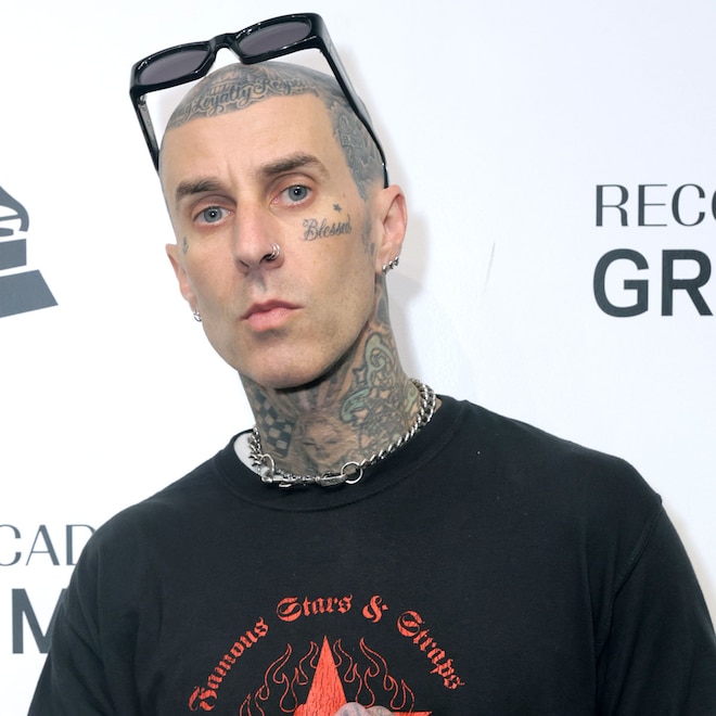 Travis Barker Suffers Leg Injury Training for L.A. Marathon