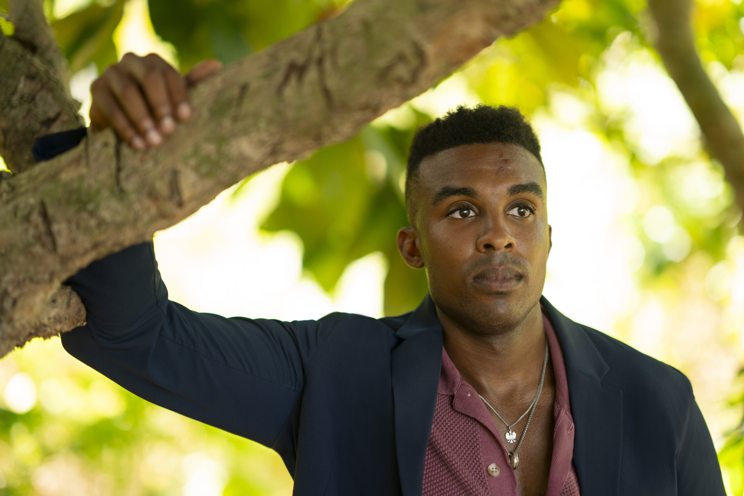 ‘Survivor 50’ Star Kyle Fraser Opens Up About His Painful Injury and Exit From the Game: “Tough Pill to Swallow”